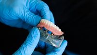 Implantate-Zahnprothese-Zahnarzt Schm&uuml;cker