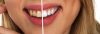 Zahnarzt Schmücker in Ottobeuren - Schöne und gesunde Zähne